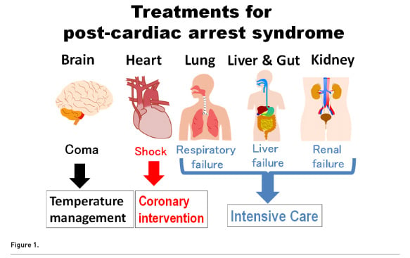 Chain Of Survival After Out Of Hospital Cardiac Arrest Healthmanagement Org