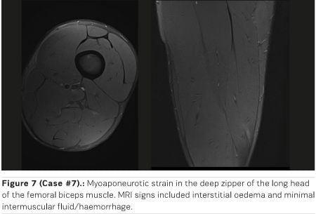 Critical analysis of MRI-based classification systems for