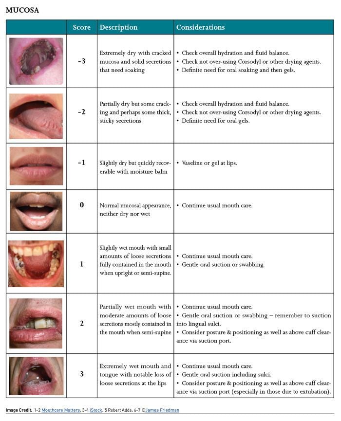 Mouth Care Challenges and the Use of the COVID-19 Oral Grading System ...