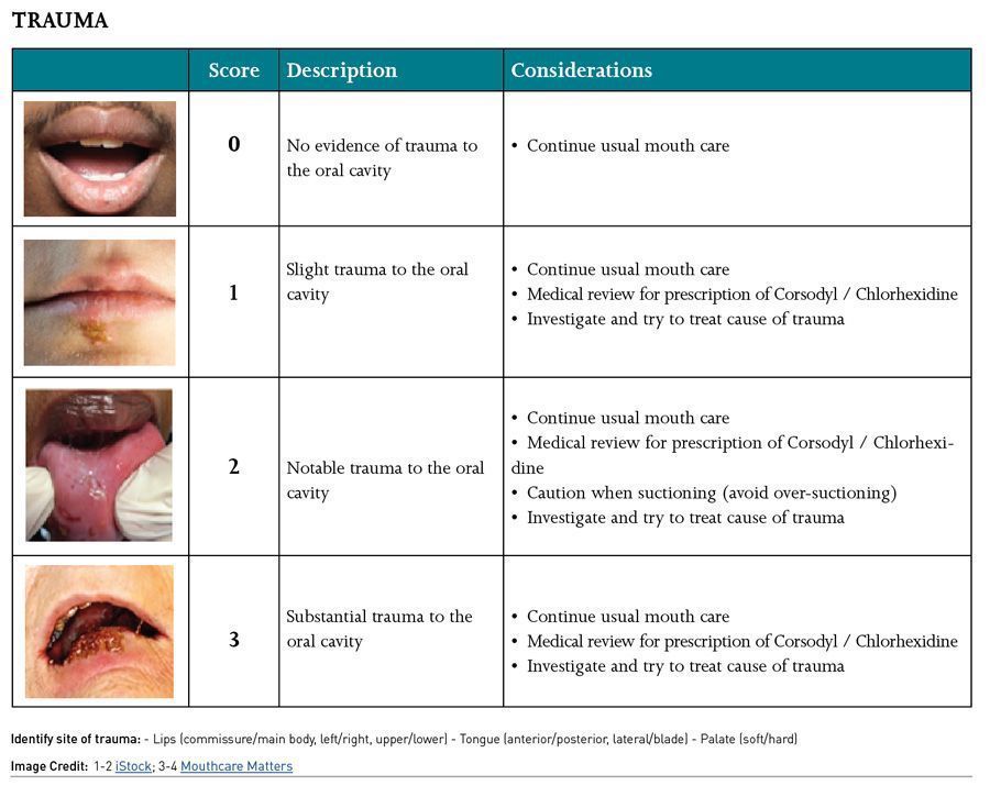 Mouth Care Challenges and the Use of the COVID-19 Oral Grading System ...