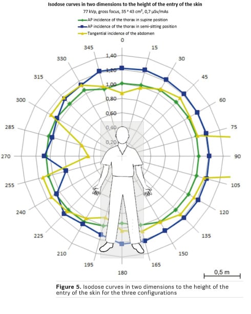 Scatter Radiation Exposure During Mobile X Ray Examinations Healthmanagement Org