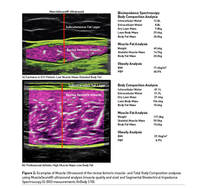 Measurement of skeletal muscle mass using the bioelectrical