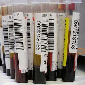 blood samples blood samples