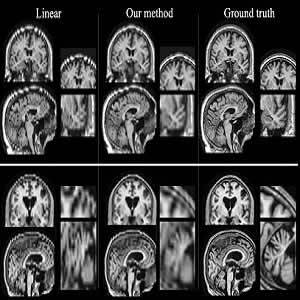 Researchers at MIT and other institutions have devised a way to boost the quality of low-resolution patient MRI scans so they can be used for large-scale studies. Images produced by their algorithm, shown in the center column, are much closer to high-reso Researchers at MIT and other institutions have devised a way to boost the quality of low-resolution patient MRI scans so they can be used for large-scale studies. Images produced by their algorithm, shown in the center column, are much closer to high-reso
