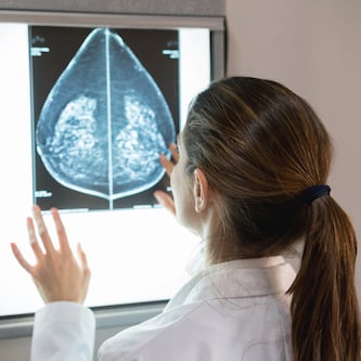 Dense Breasts Breast Cancer Risk And Screening Choices In 19 Healthmanagement Org
