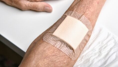 Image: Arm of a person with a wound dressing applied