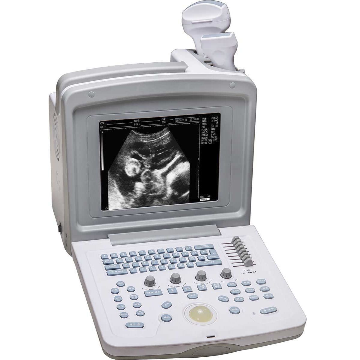 Portable veterinary ultrasound system WED-180V Shenzhen Well.D Medical Electronics