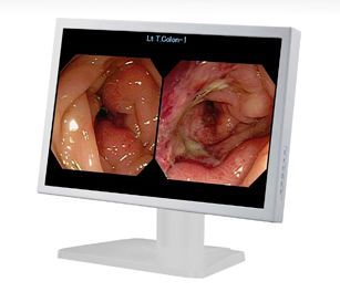 Surgical display 19'' | E190 Shenzhen Beacon Display Technology Co., Ltd.