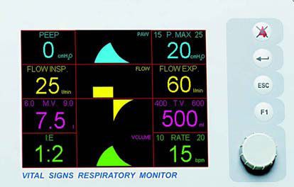 Artificial ventilation monitor M3000D / TFT Siare