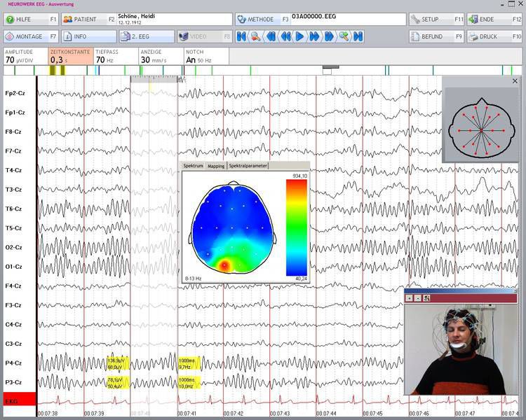 EEG software / medical EEG review SIGMA Medizin-Technik