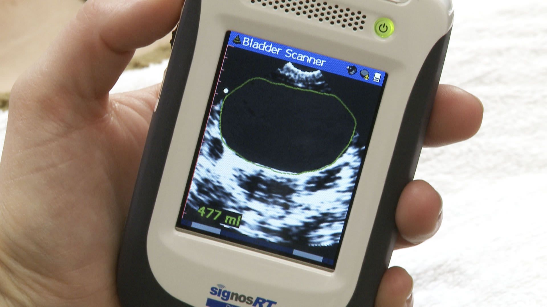 Hand-held ultrasound bladder scanner Signostics