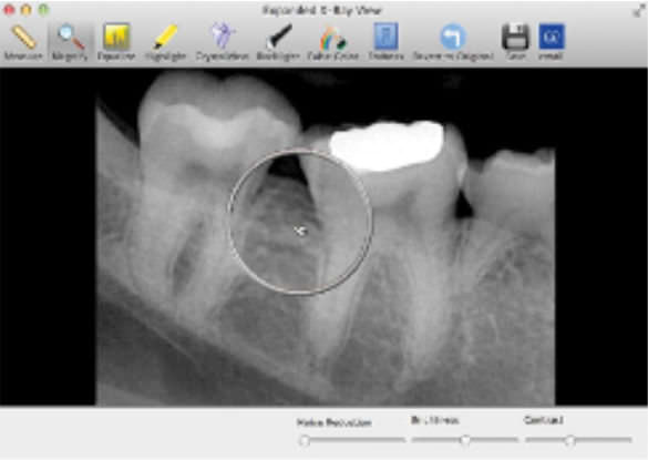 Data management software / image capture / for dental imaging SuniMac Suni Medical Imaging
