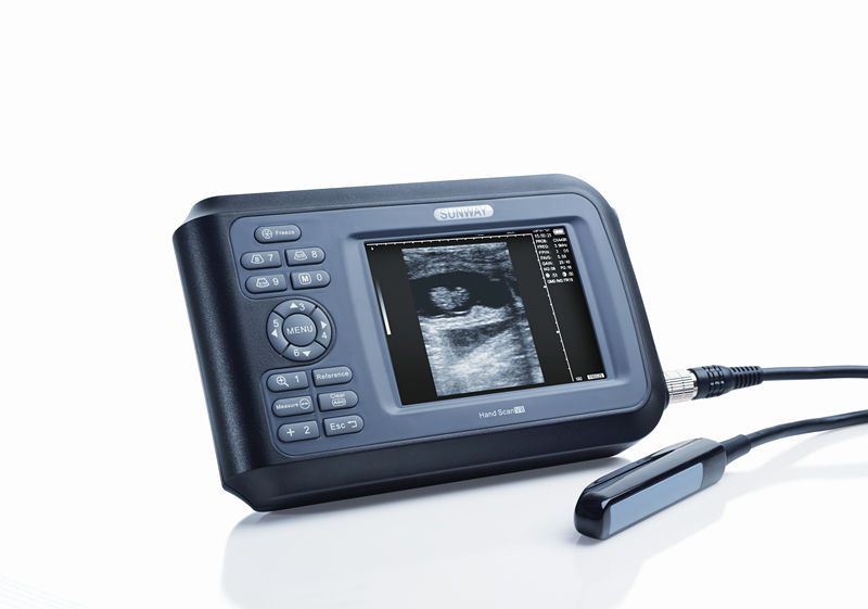 Hand-held veterinary ultrasound system Handscan V8 Sunway Medical