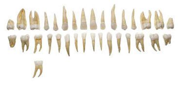 Tooth anatomical model ES 1 SOMSO