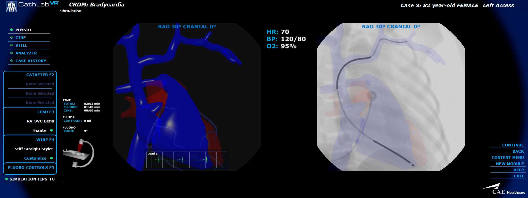 Cardiovascular catheterization simulator CathLabVR CAE Healthcare