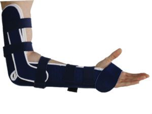 Elbow splint (orthopedic immobilization) Chrisofix