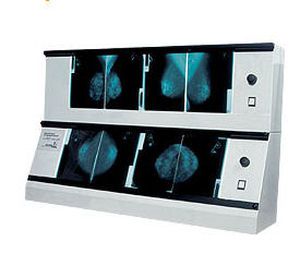 White light X-ray film viewer / 8-section / variable-speed / with switch 5500 cd/m², 72 x 24 cm | 2 x NGP-21 m Ultraviol