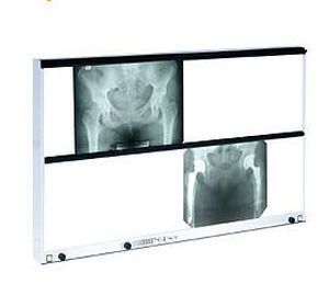 White light X-ray film viewer / multi-section / variable-speed / with switch 4100 cd/m², 2 x 150 x 45 cm | NGP-800 R Ultraviol