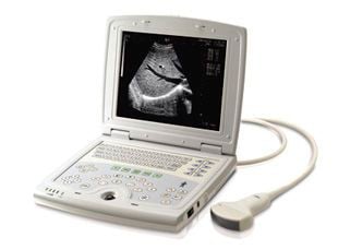 Portable ultrasound system / for gynecological and obstetric ultrasound imaging KX5000 Xuzhou Kaixin Electronic Instrument