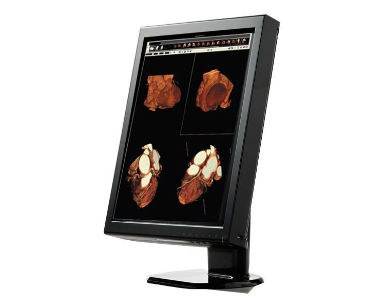 LCD display / medical 21.2", 3 MP | CX31 WIDE Europe
