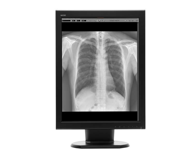 Monochrome display / medical 20.8", 3 MP | MX30s WIDE Europe