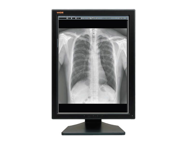 Monochrome display / medical 20.8", 3 MP | IF2103MP WIDE Europe