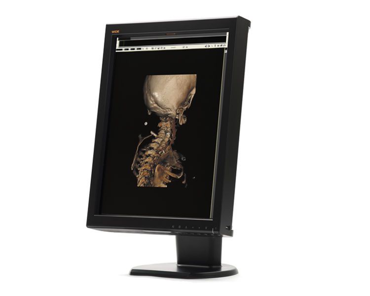 LCD display / medical 21.3", 2 MP | CX20p WIDE Europe