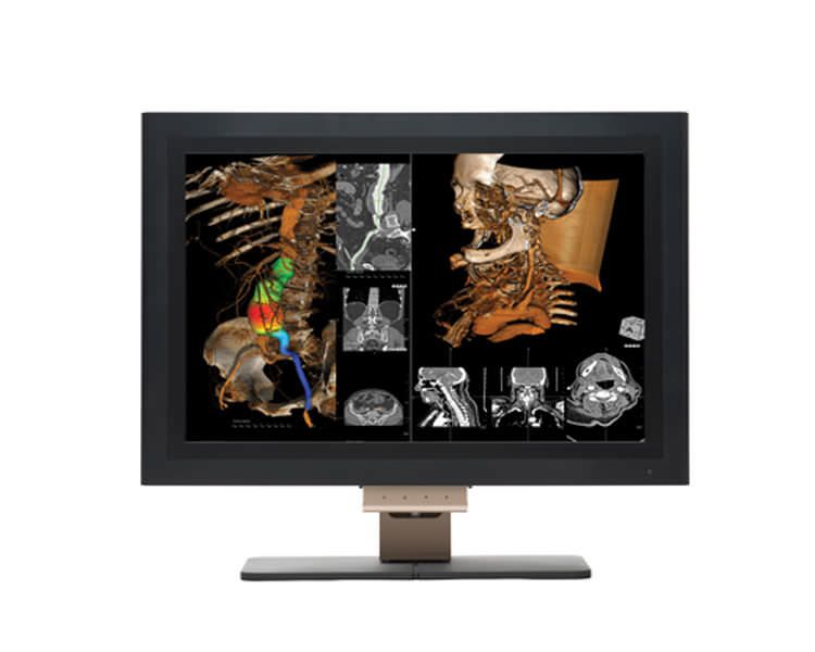 LCD display / medical 21.2", 3 MP | CX31p WIDE Europe