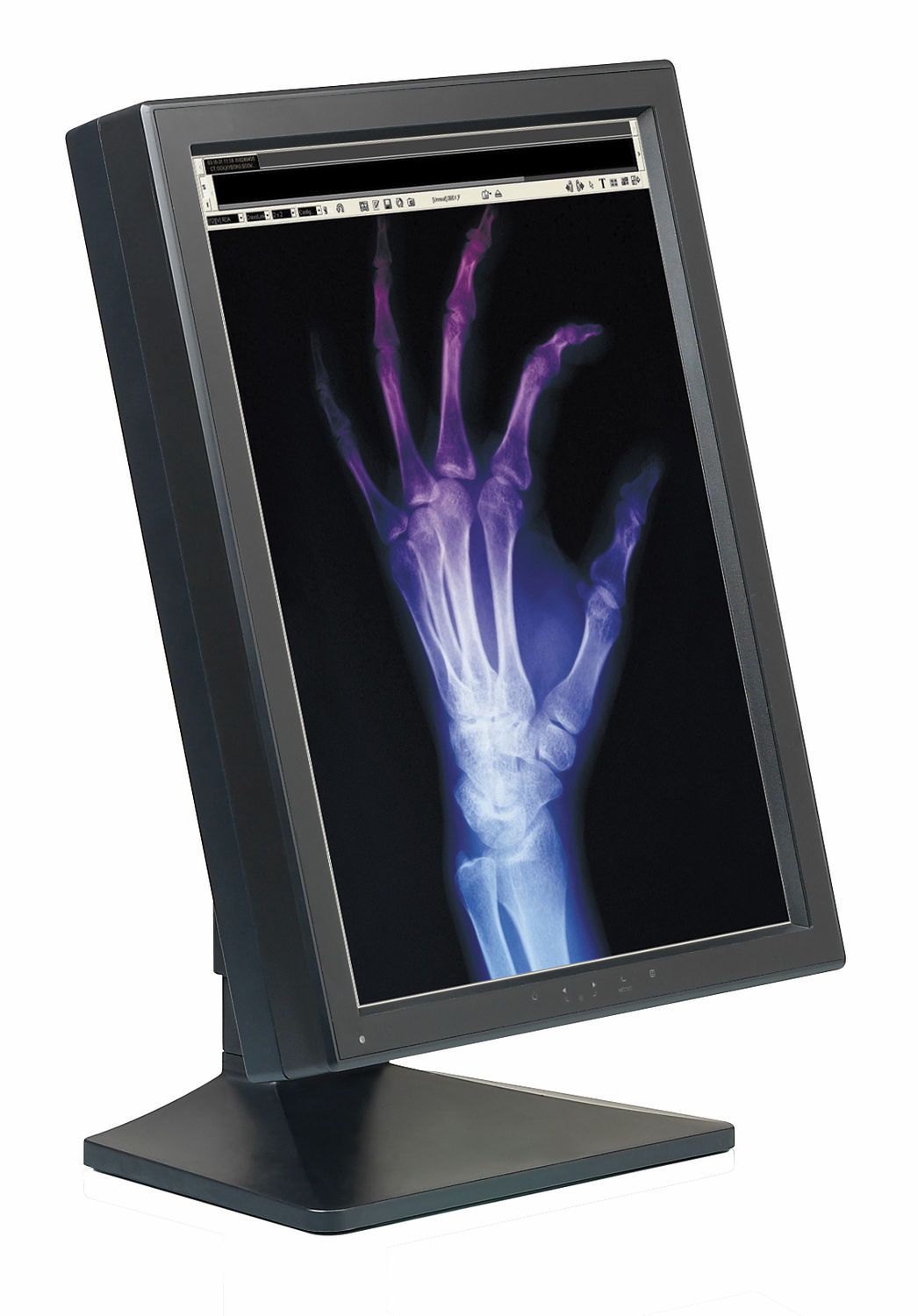 LCD display / medical 20.8", 3 MP | FPP2080CP Canvys
