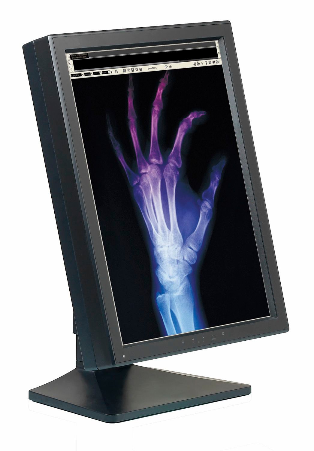 LCD display / medical 20.8", 3 MP | FPP2080CP Canvys