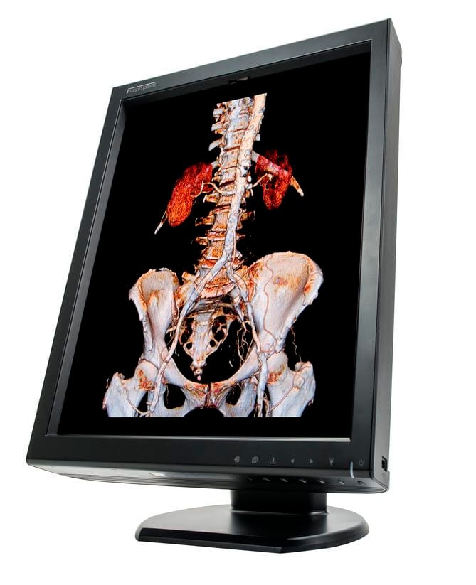 LCD display / medical 21,2" | XLED3MPC Canvys