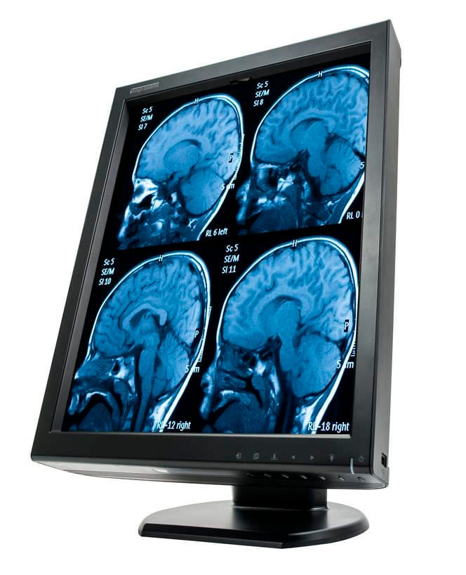 LCD display / medical 21,2" | XLED2MPC Canvys