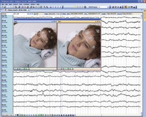 EEG software / medical Compumedics