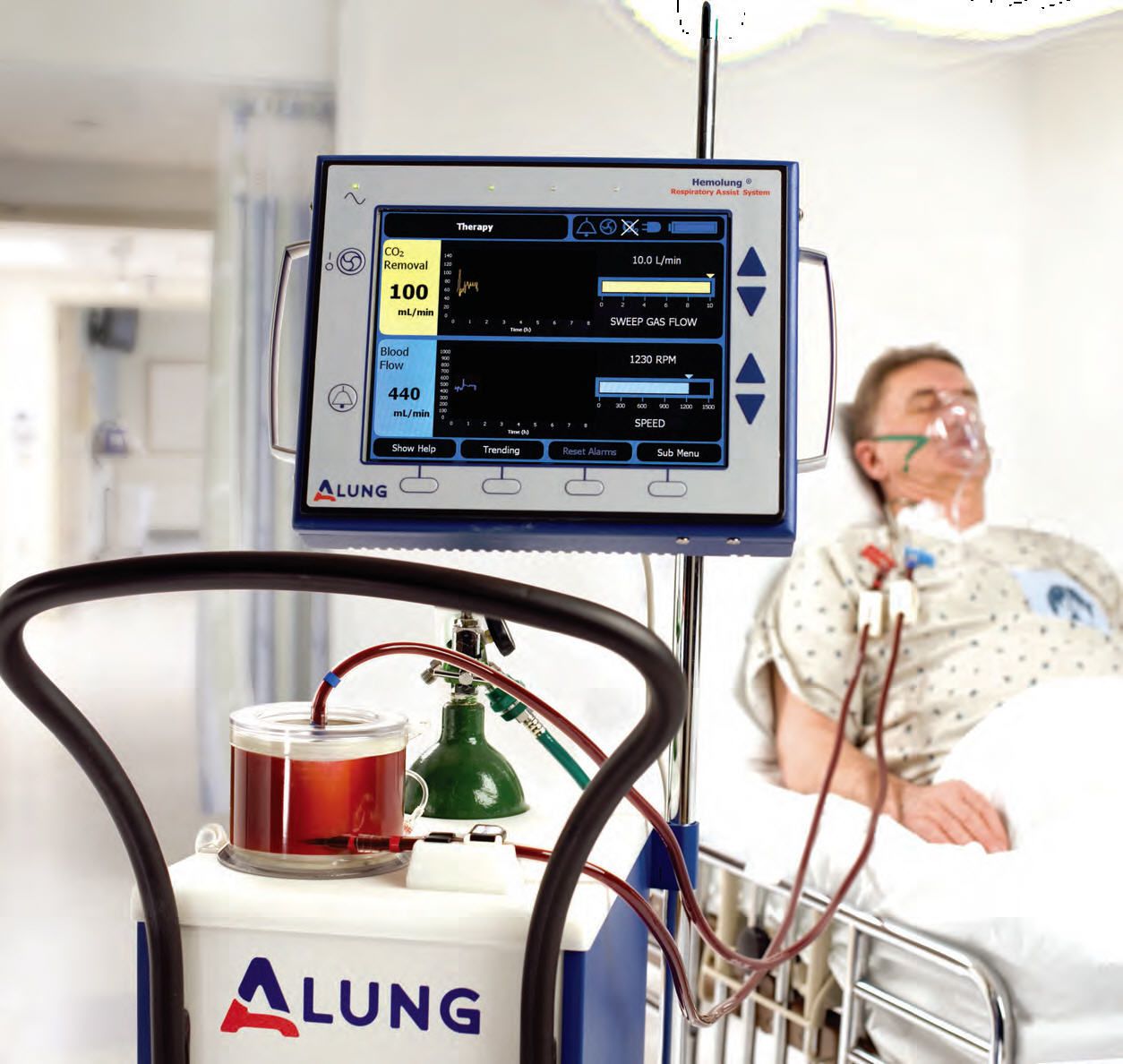 Respiratory dialysis machine Hemolung® RAS Alung Technologies