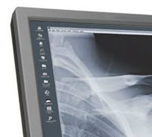 Monochrome display / medical 20.8", 3 MP | Dome E3 NDS Surgical Imaging