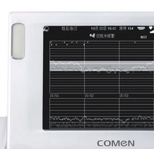 Fetal monitor STAR5000E Comen