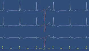 Analysis software / medical / electrocardiography Pathfinder SL Spacelabs Healthcare