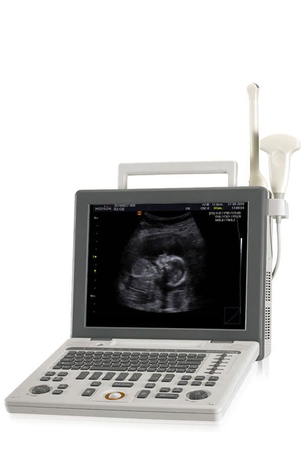 Protable, ultrasound system on trolley / for multipurpose ultrasound imaging SONOACE R3 Samsung Medison