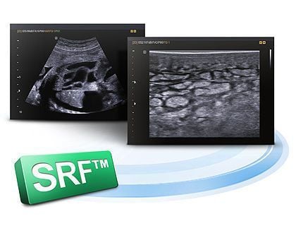 Portable veterinary ultrasound system SonoVet R3 Samsung Medison
