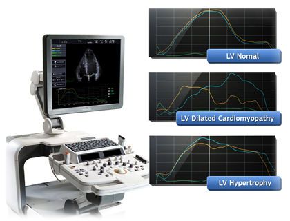 Ultrasound system / on platform / for cardiovascular ultrasound imaging EKO 7 Samsung Medison