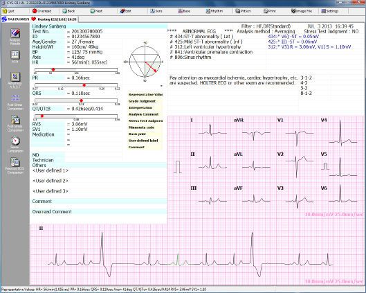 Electrocardiography software / medical Suzuken Company