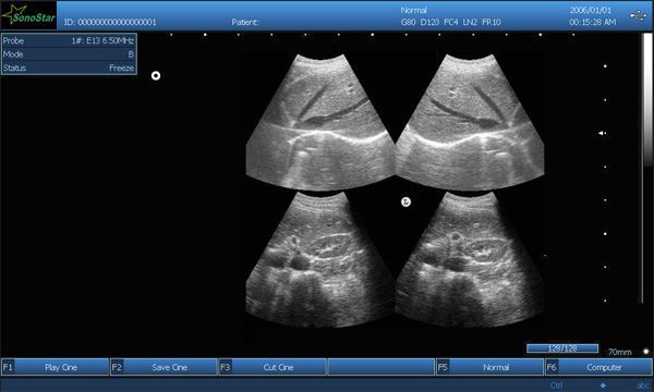 Ultrasound system / on platform / for multipurpose ultrasound imaging 15" | SS-600 Sonostar Technologies