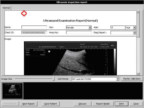 Portable veterinary ultrasound system 10" | V10(SS-10V) Sonostar Technologies