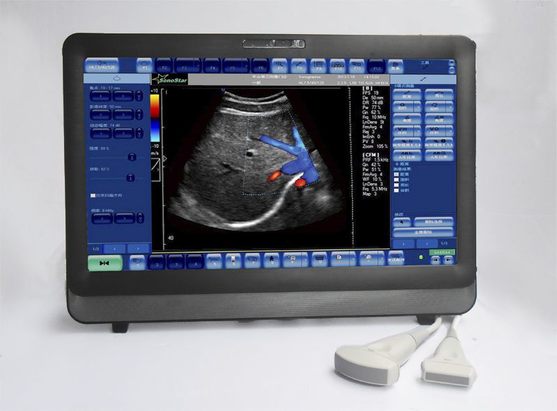 Portable ultrasound system / for multipurpose ultrasound imaging / touchscreen C8 Sonostar Technologies