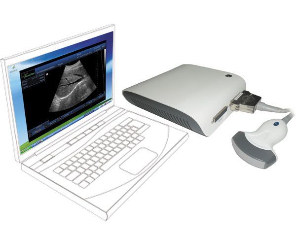 Portable ultrasound system / for multipurpose ultrasound imaging UBox-10 Sonostar Technologies