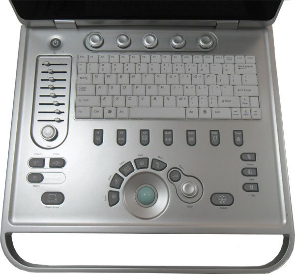 Portable ultrasound system / for gynecological and obstetric ultrasound imaging 15" TFT | SS-7 Sonostar Technologies
