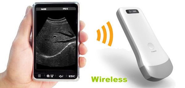 Hand-held ultrasound system / for multipurpose ultrasound imaging / all-in-one probe / wireless probe UProbe-2 Sonostar Technologies