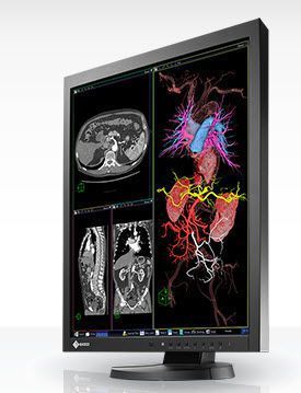 LCD display / medical 21.3", 2 MP | RadiForce MX215 EIZO Corporation