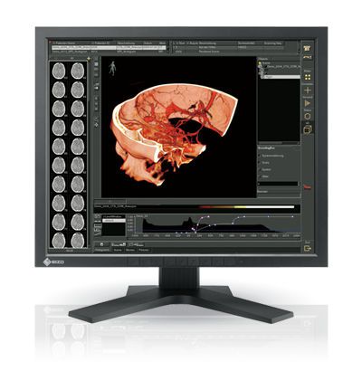 LCD display / medical 19", 1 MP | RadiForce RS110 EIZO Corporation