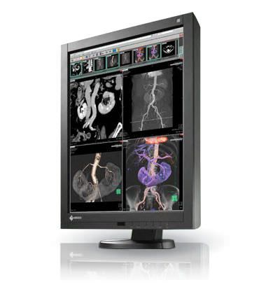 LCD display / high-definition / medical 21.2", 3 MP | RadiForce RX340 EIZO Corporation